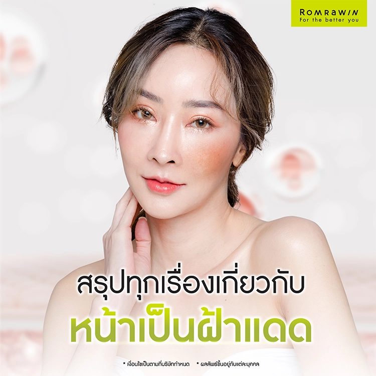 ฝ้าแดด