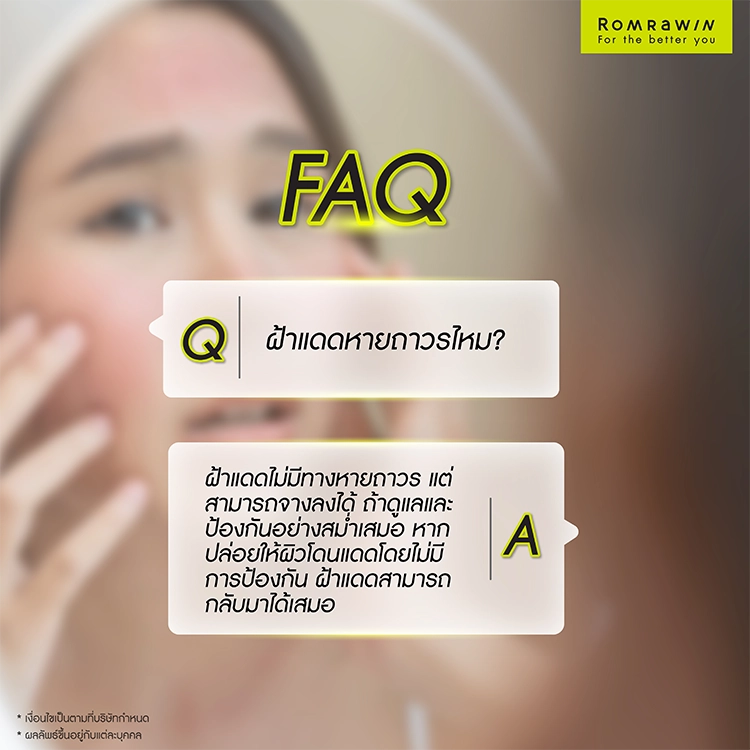 ฝ้าแดด