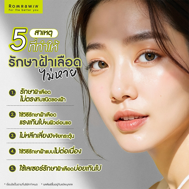 รักษาฝ้าเลือด