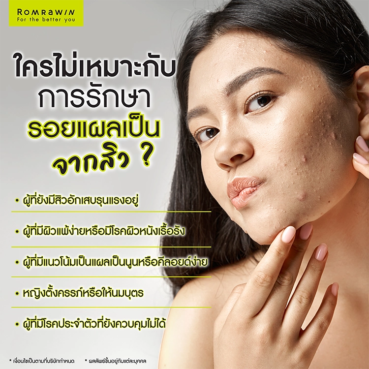 แผลเป็นจากสิว