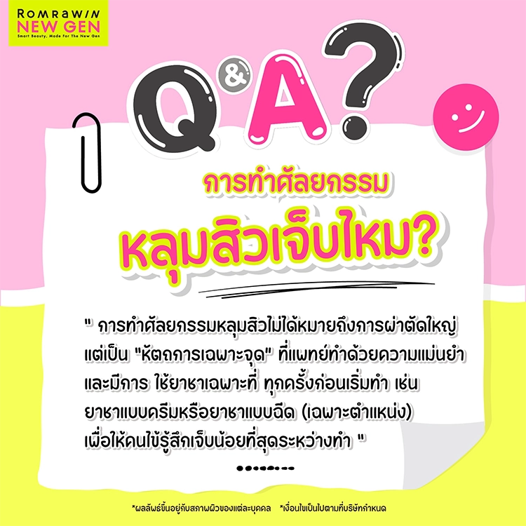 ศัลยกรรมหลุมสิว