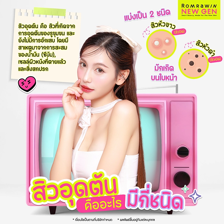สิวอุดตันใช้อะไรดี