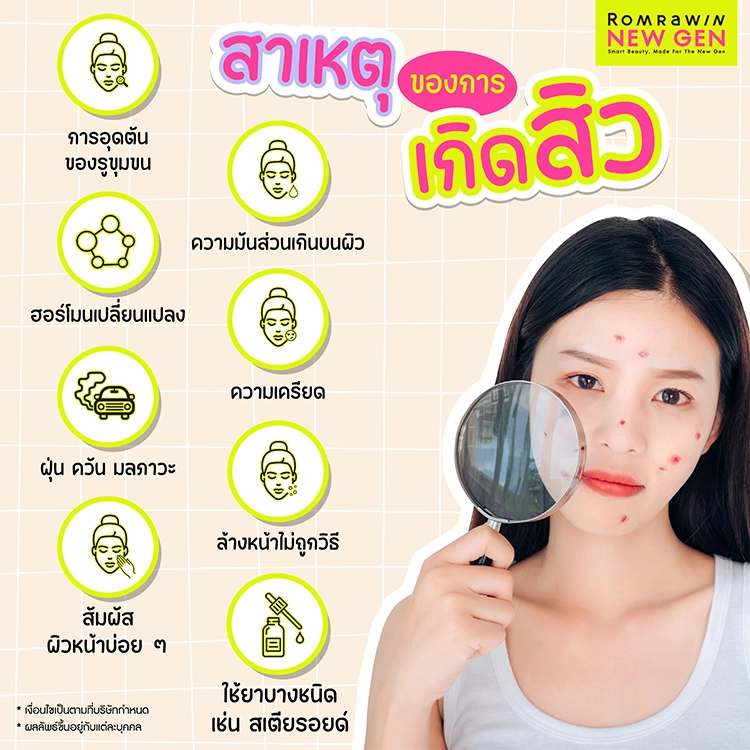 สิวอุดตันใช้อะไรดี