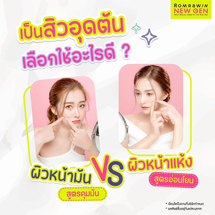 สิวอุดตันใช้อะไรดี