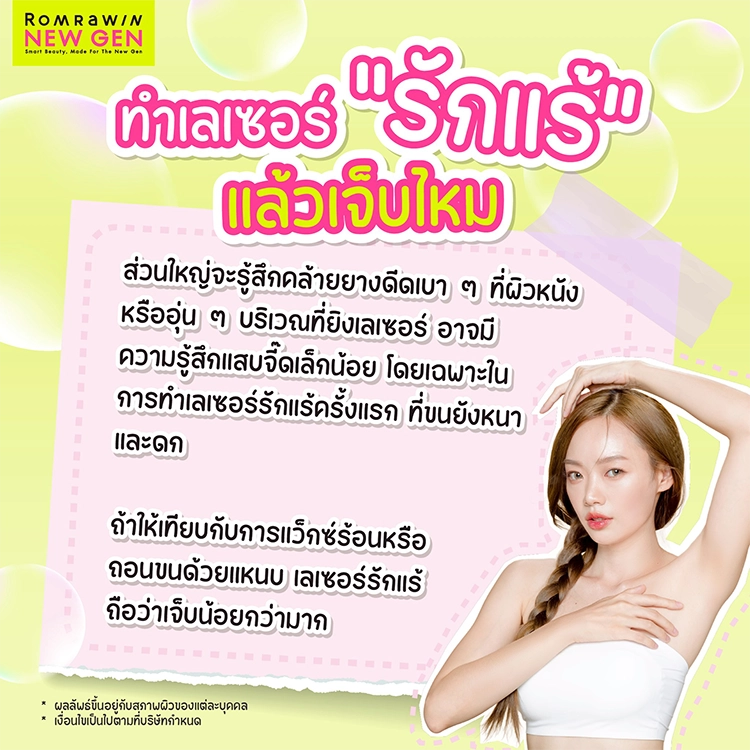 เลเซอร์รักแร้