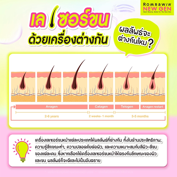 เลเซอร์ขนหน้า