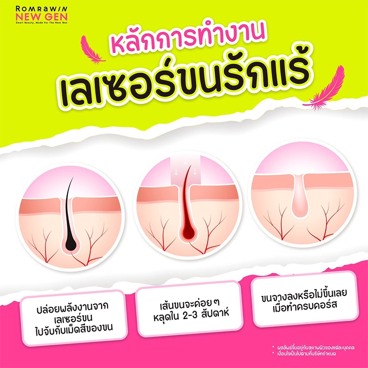 เลเซอร์ขนรักแร้ 590