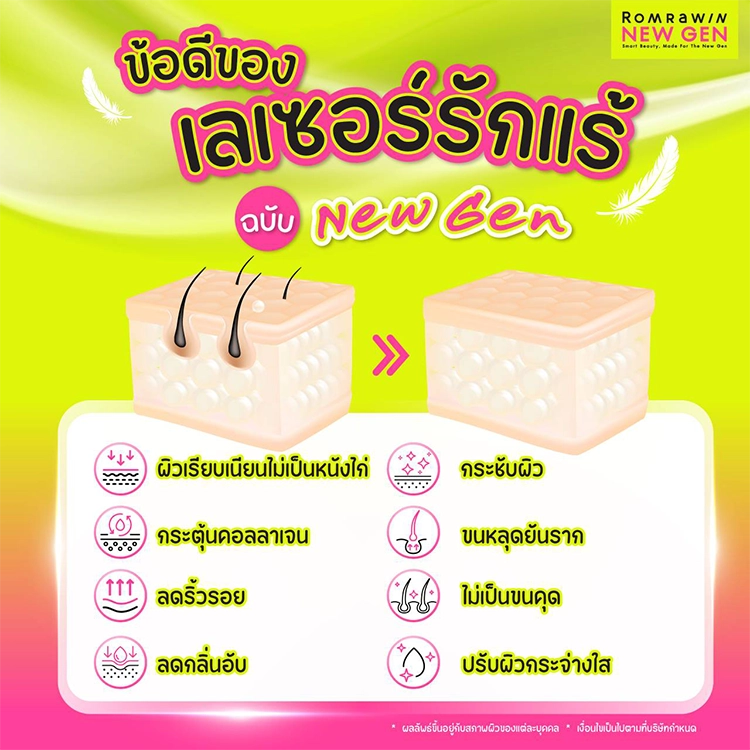 เลเซอร์ขนรักแร้ 590