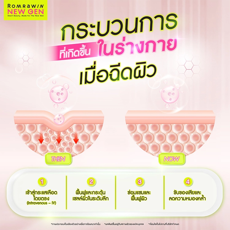 ฉีดผิว