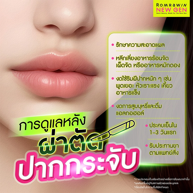 ปากกระจับ