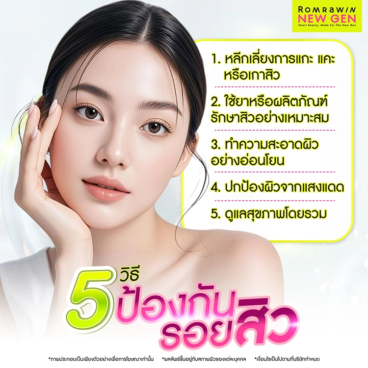 รักษาแผลสิว