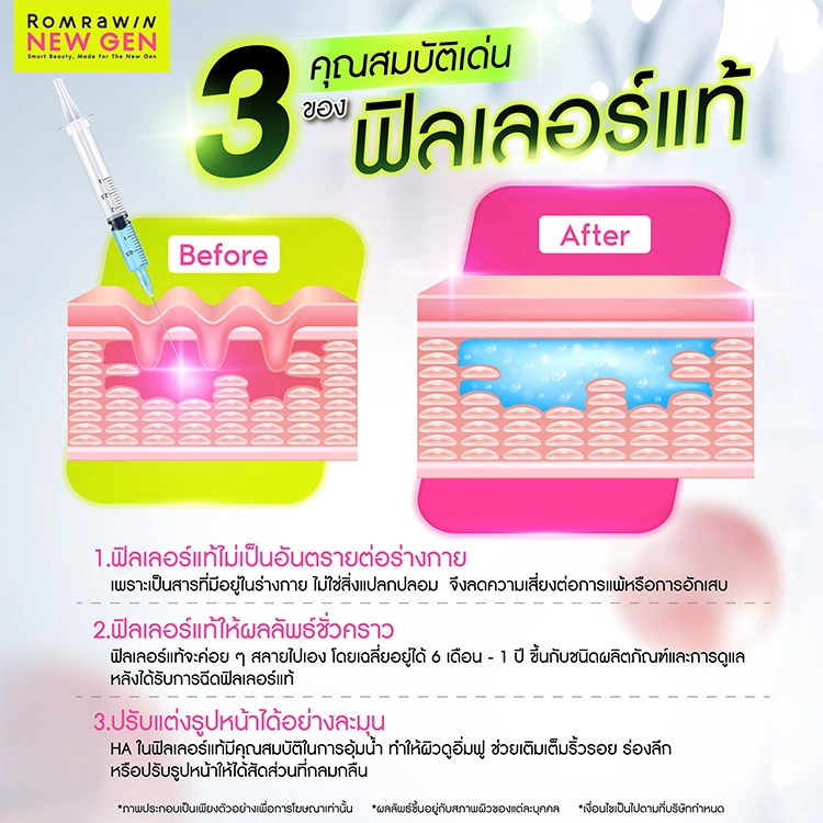 ฟิลเลอร์แท้