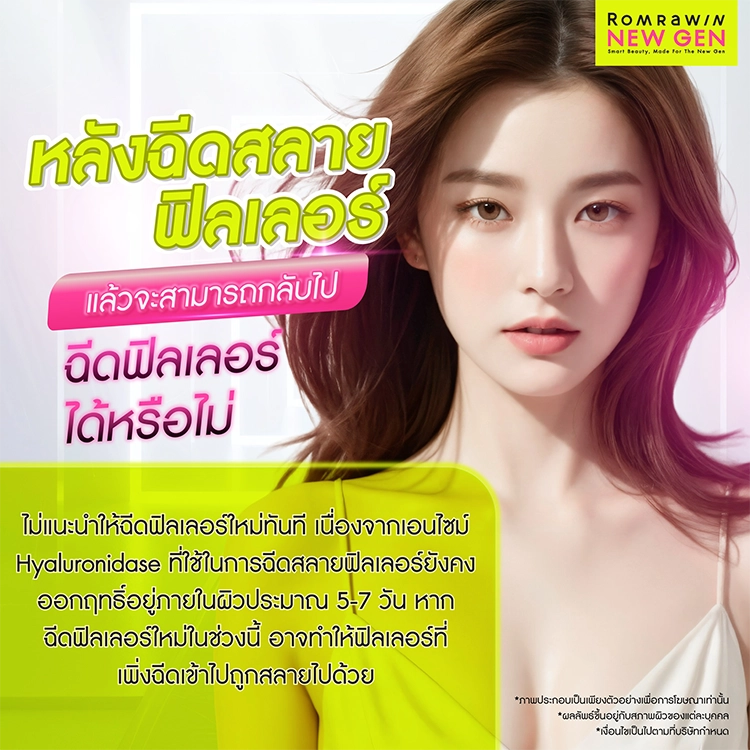 ฉีดสลายฟิลเลอร์