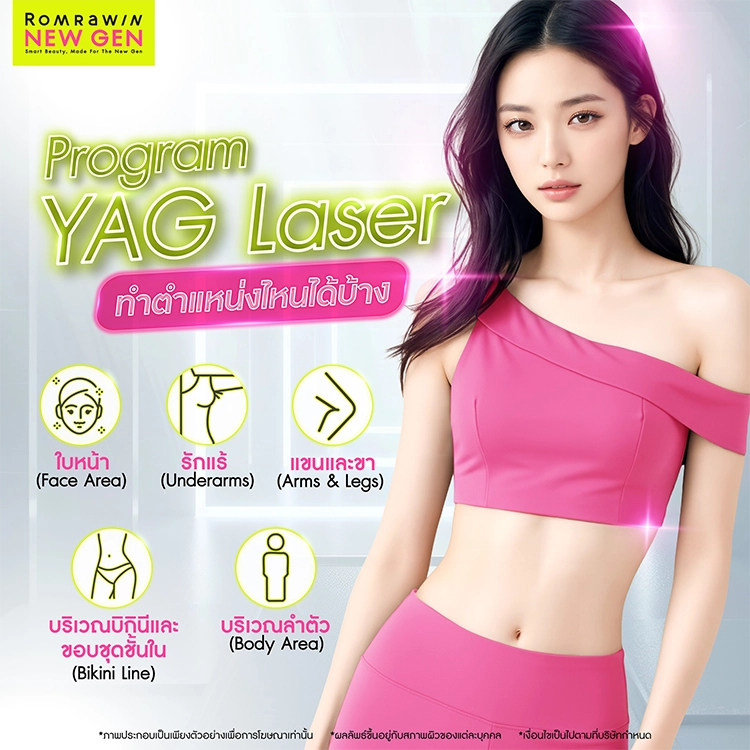 YAG Laser