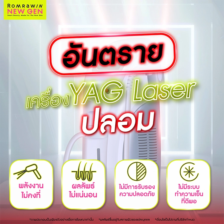 YAG Laser