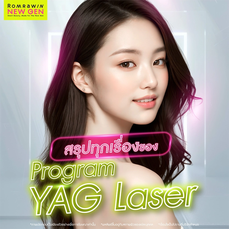 YAG Laser