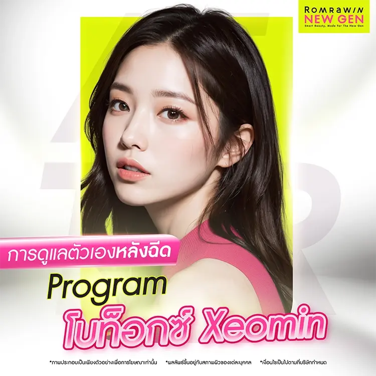 โบท็อกซ์ Xeomin