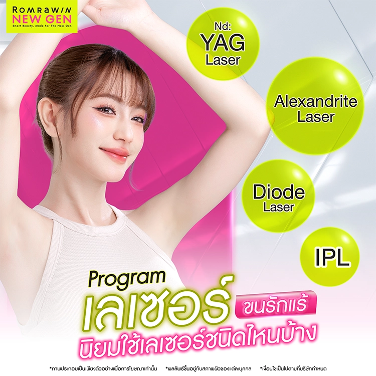 เลเซอร์ขนรักแร้