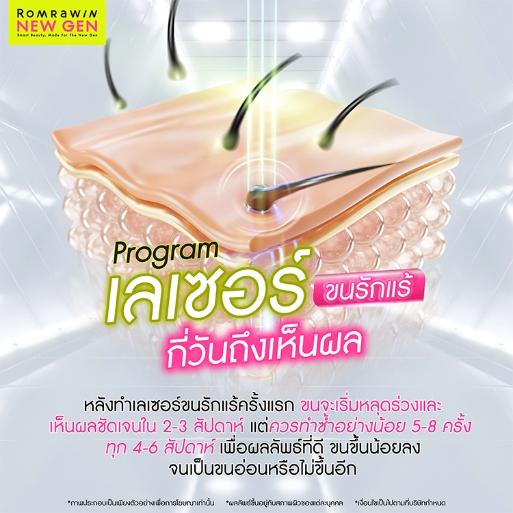 เลเซอร์ขนรักแร้