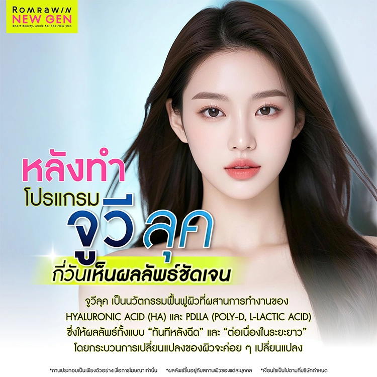 จูวีลุค