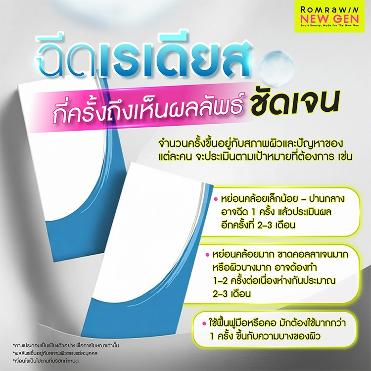 เรเดียส