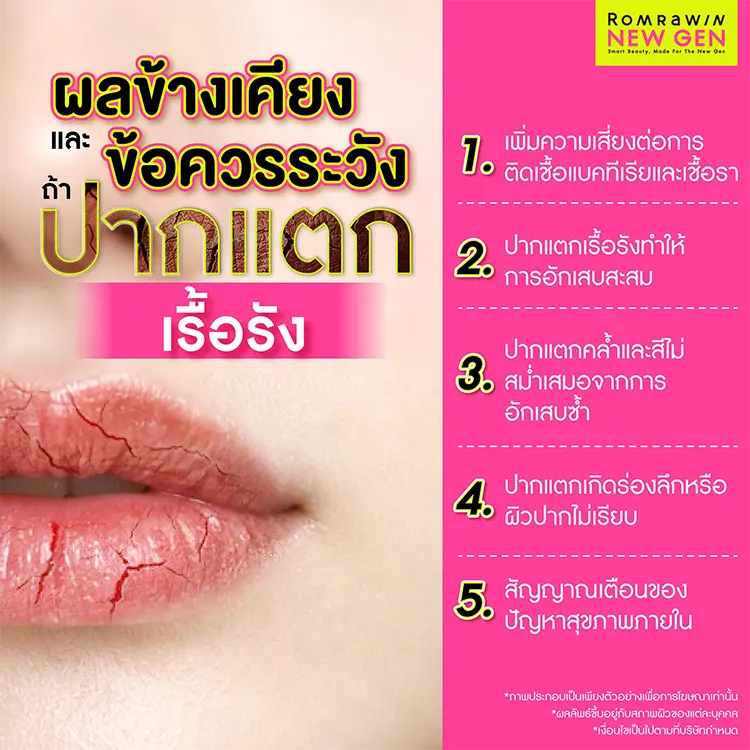 ปากแตก