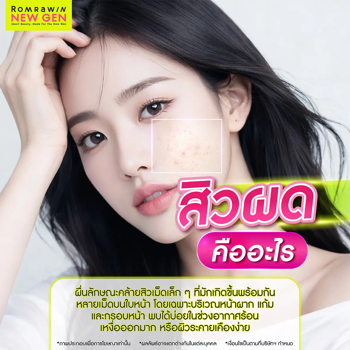 วิธีรักษาสิวผด