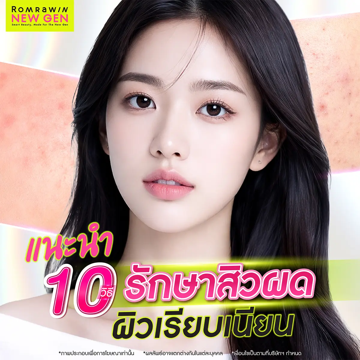 วิธีรักษาสิวผด