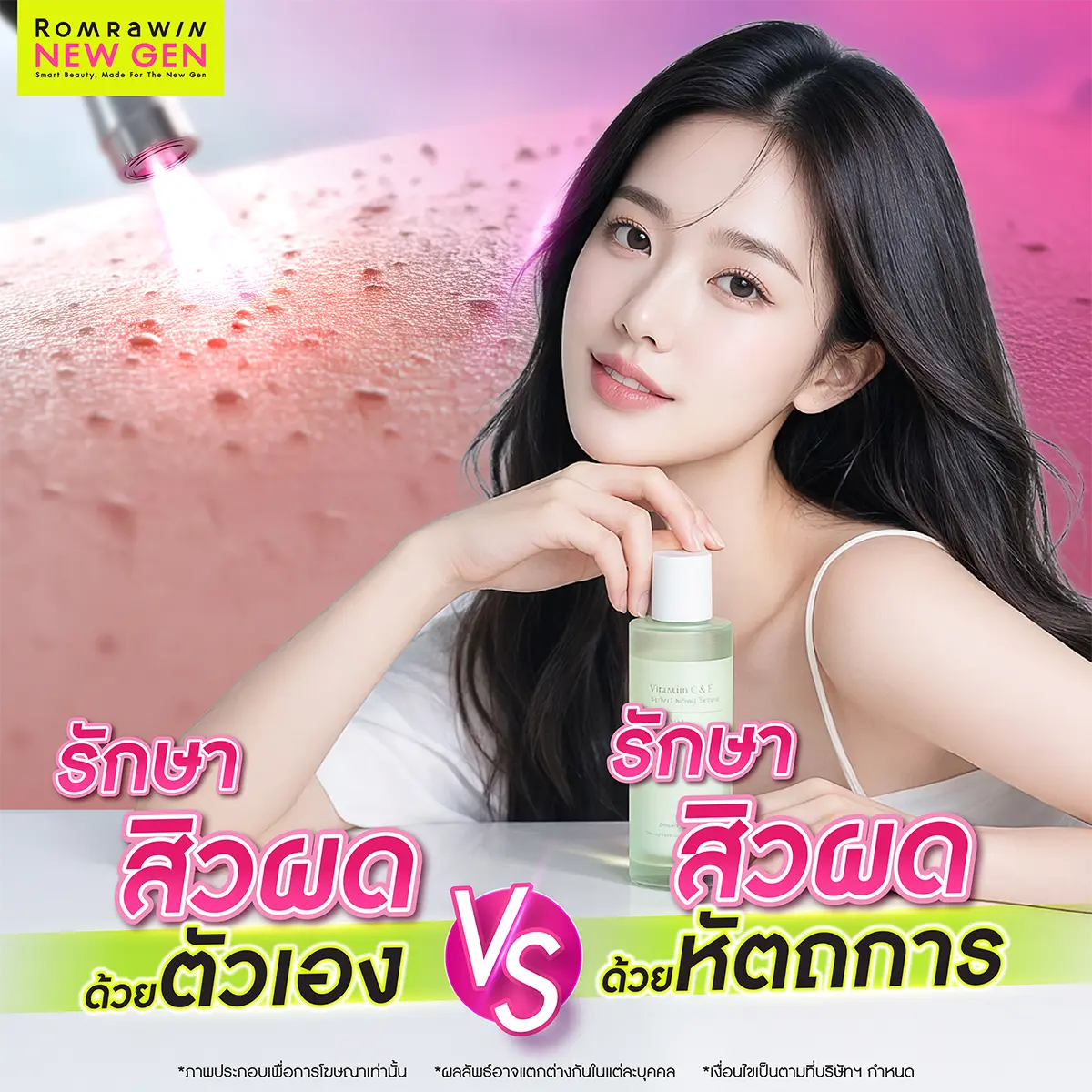 วิธีรักษาสิวผด