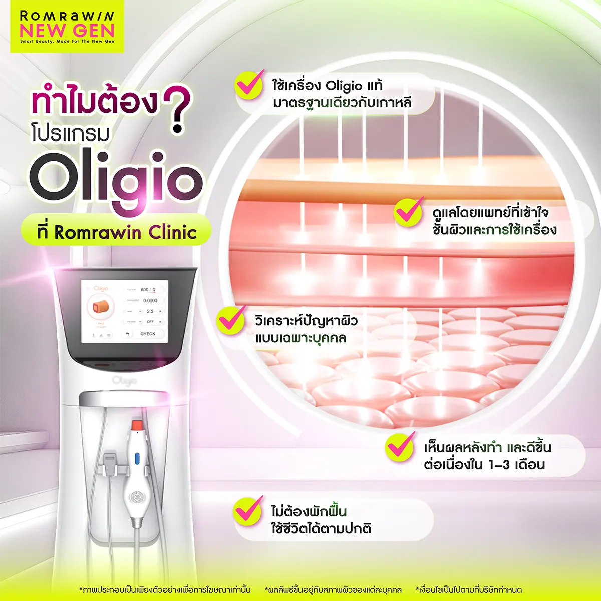 Oligio 3990