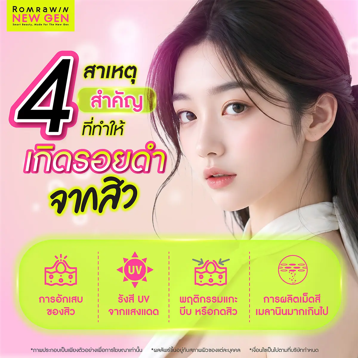 ลดรอยดำจากสิว