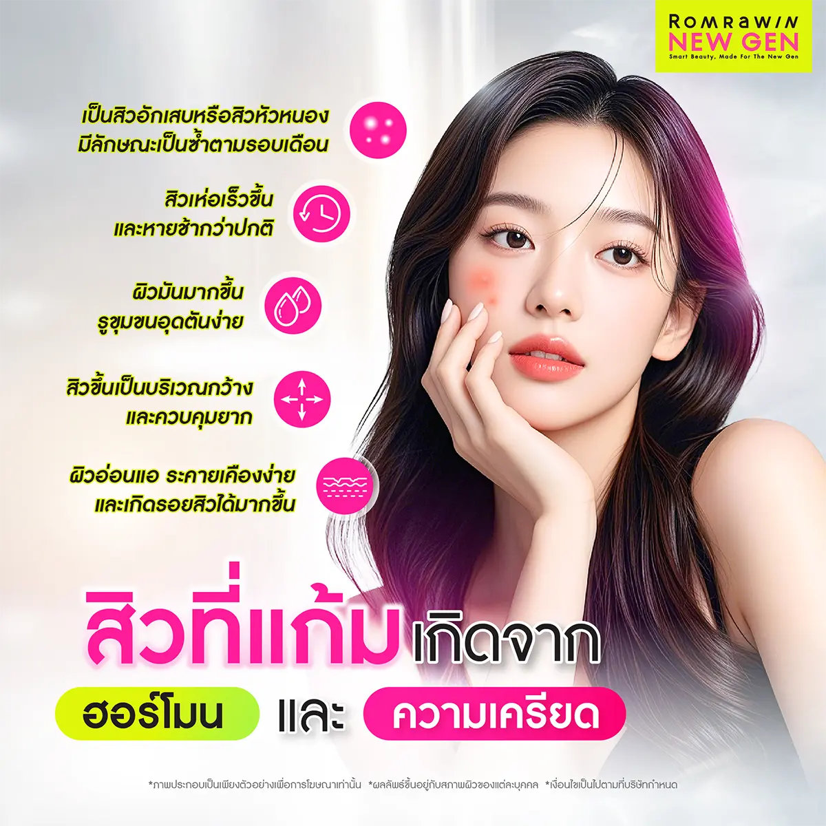 สิวที่แก้มเกิดจาก