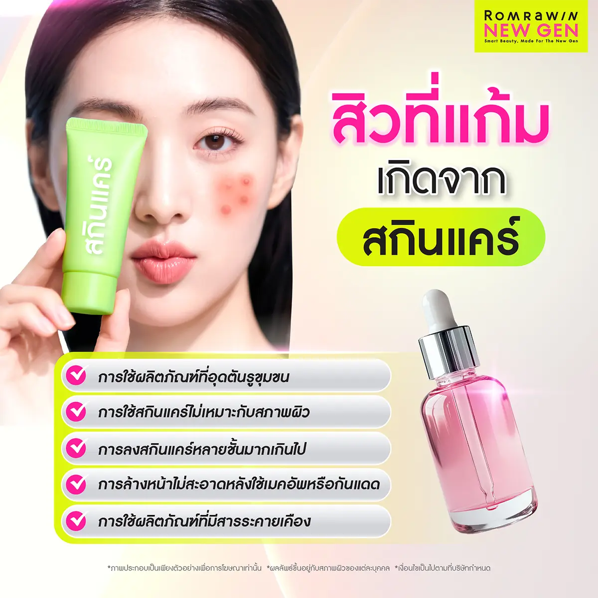 สิวที่แก้มเกิดจาก