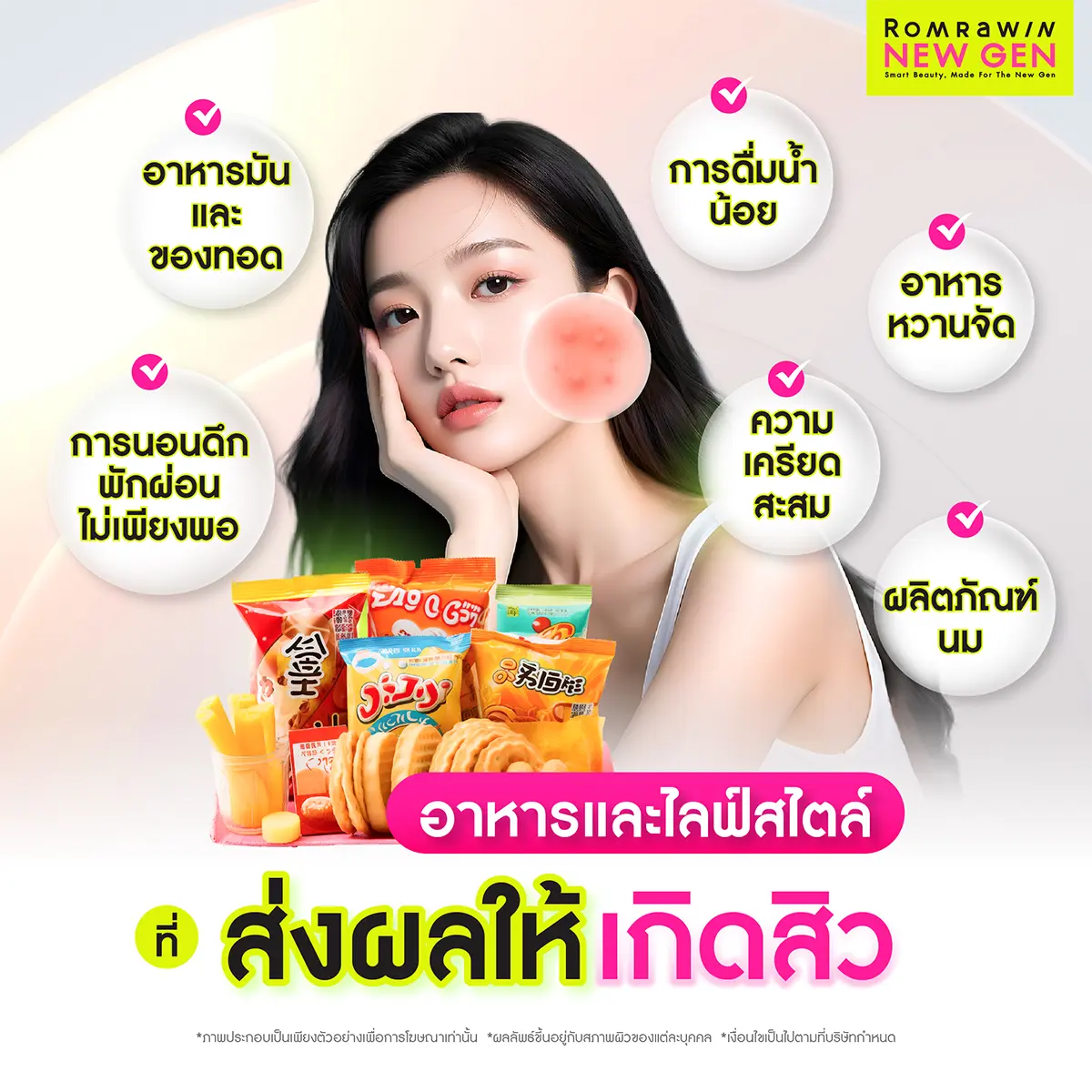 สิวที่แก้มเกิดจาก
