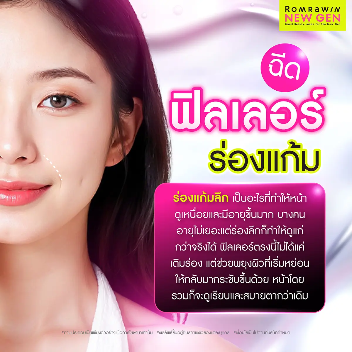 ฟิลเลอร์