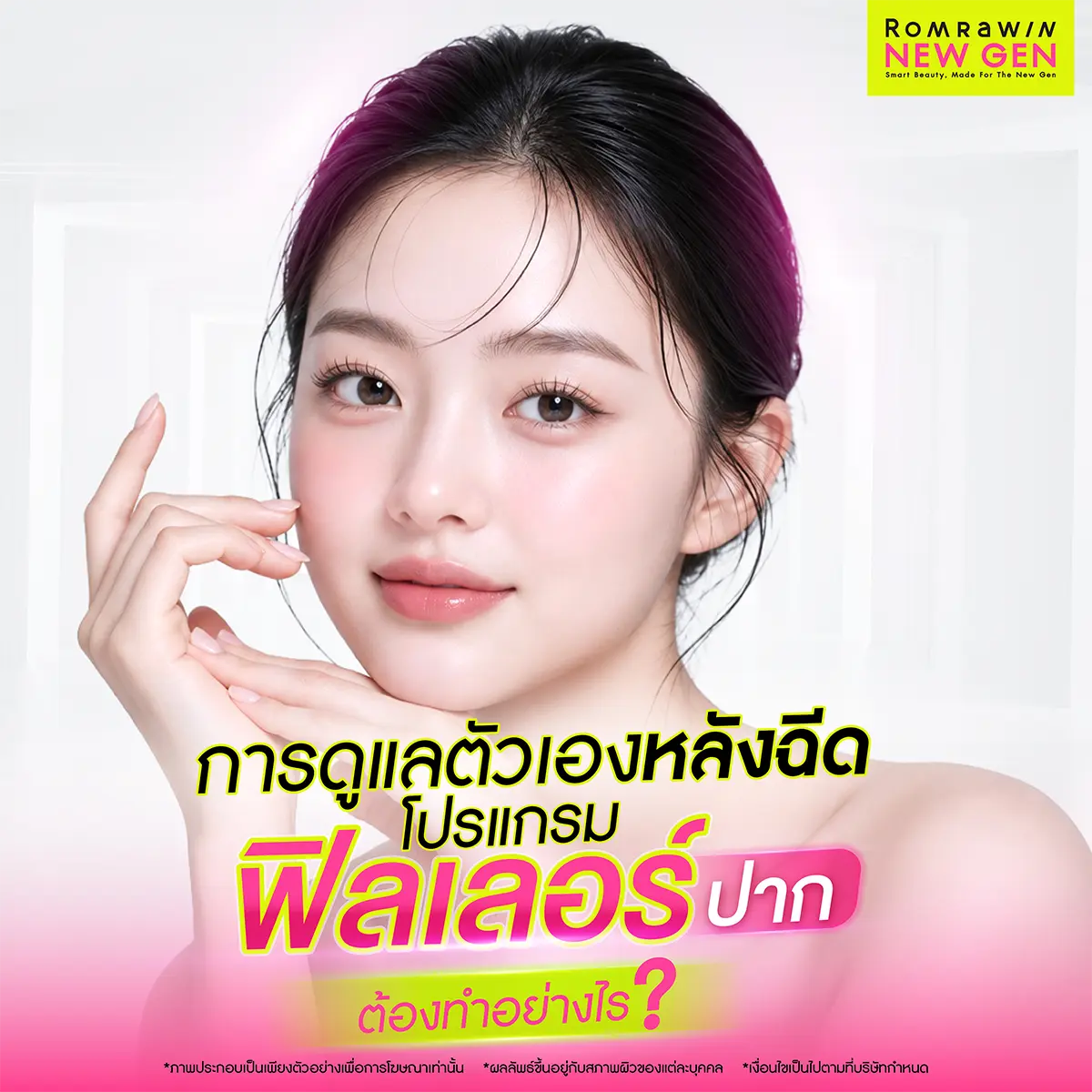 หลังฉีดฟิลเลอร์ปาก