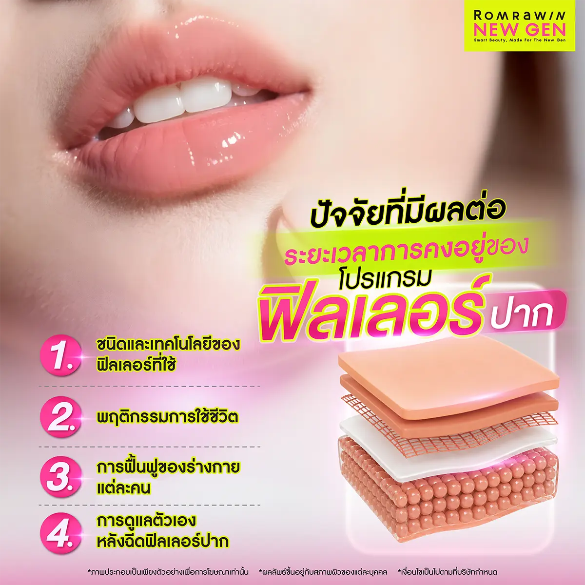 ปัจจัยที่มีผลต่อระยะเวลาการคงอยู่ของโปรแกรมฟิลเลอร์ปาก