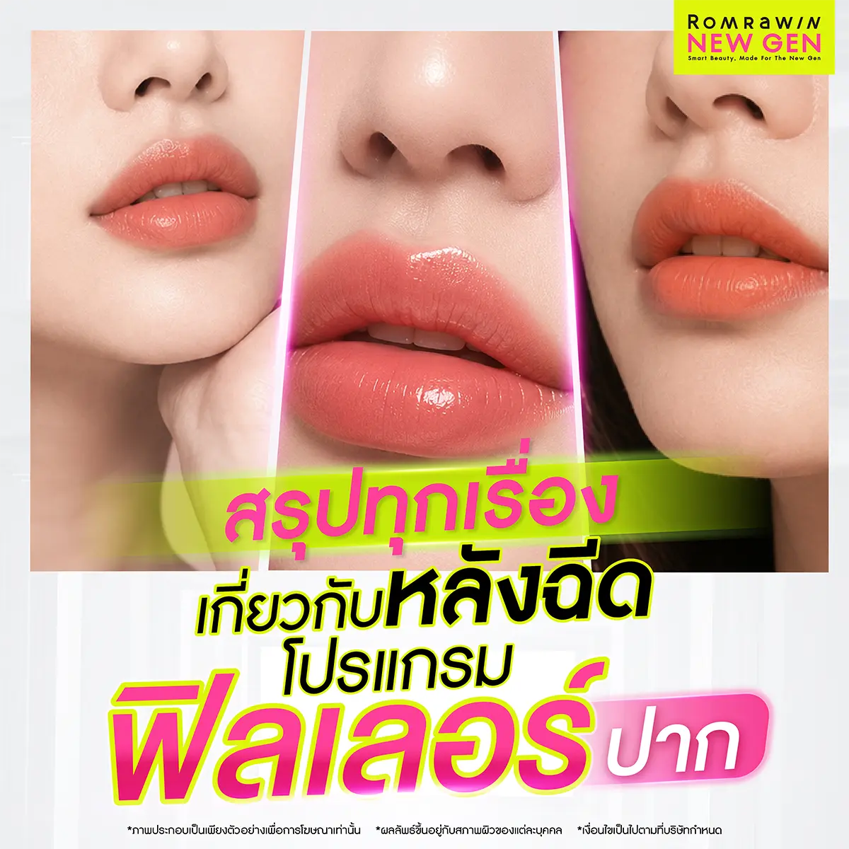 สรุปทุกเรื่องเกี่ยวกับหลังฉีดโปรแกรมฟิลเลอร์ปาก