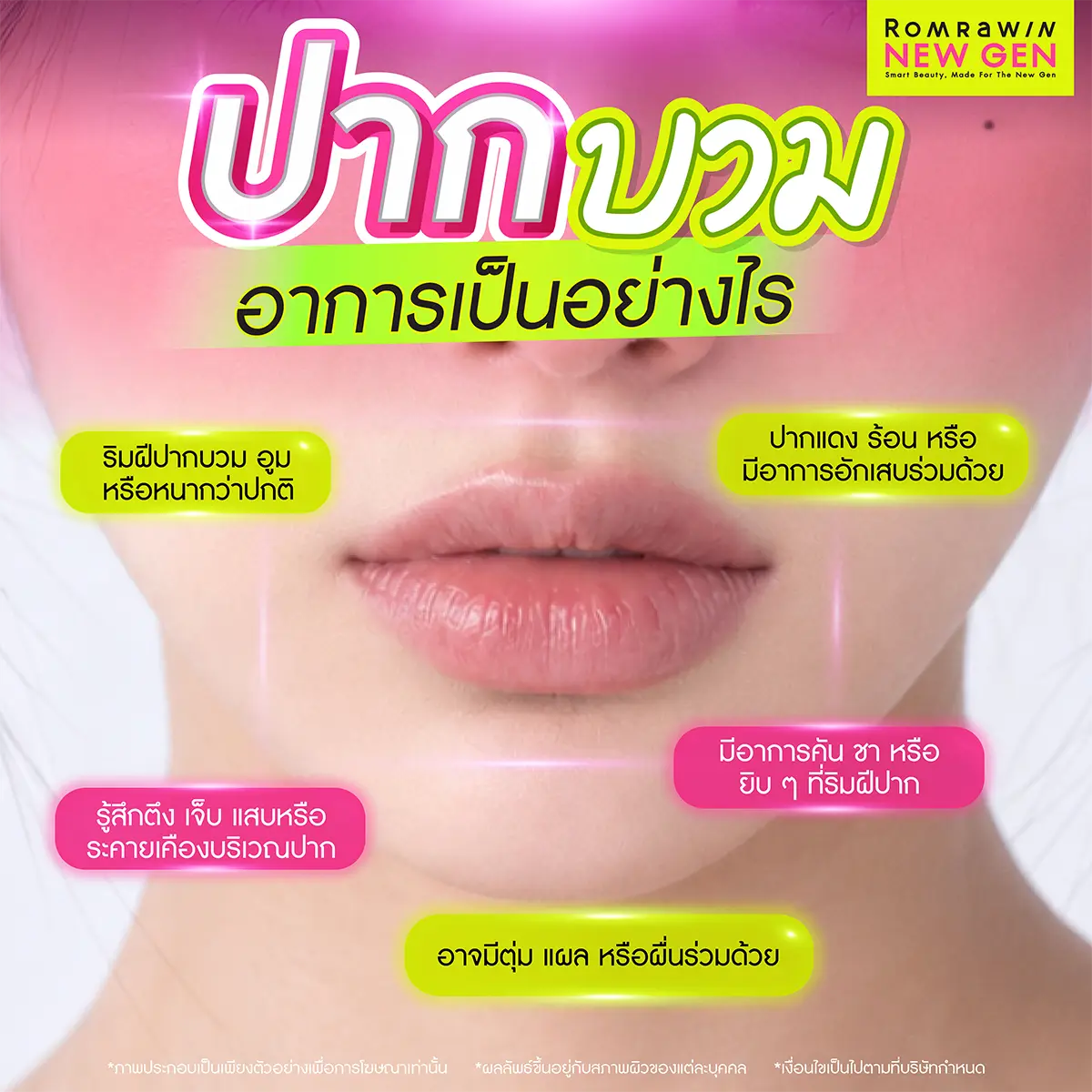 ปากบวม