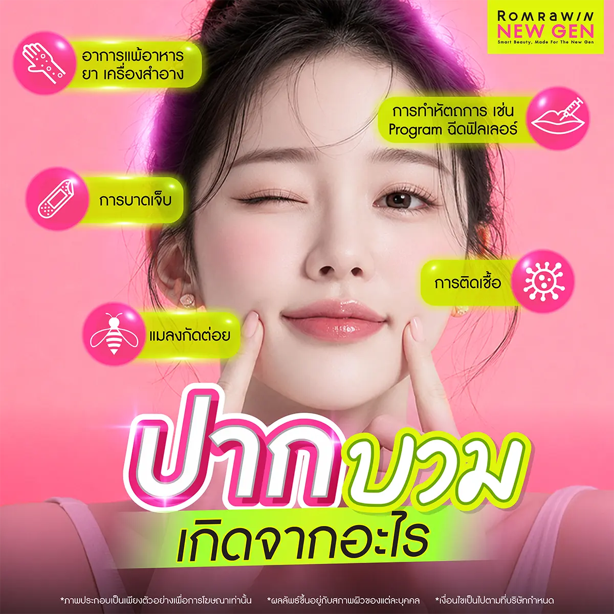 ปากบวม