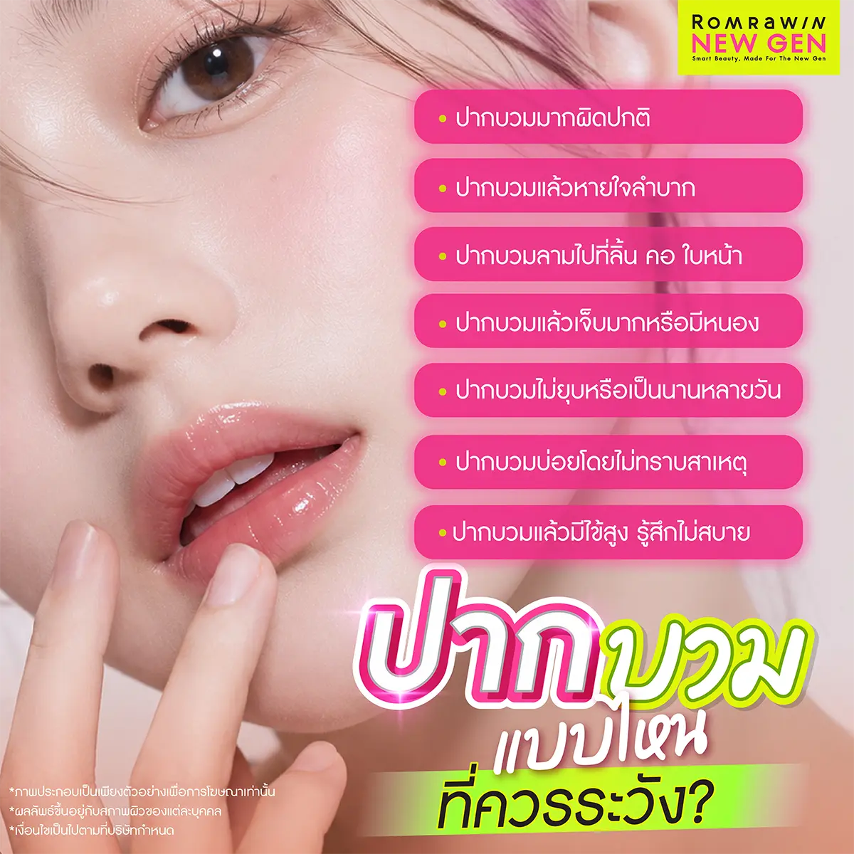 ปากบวม