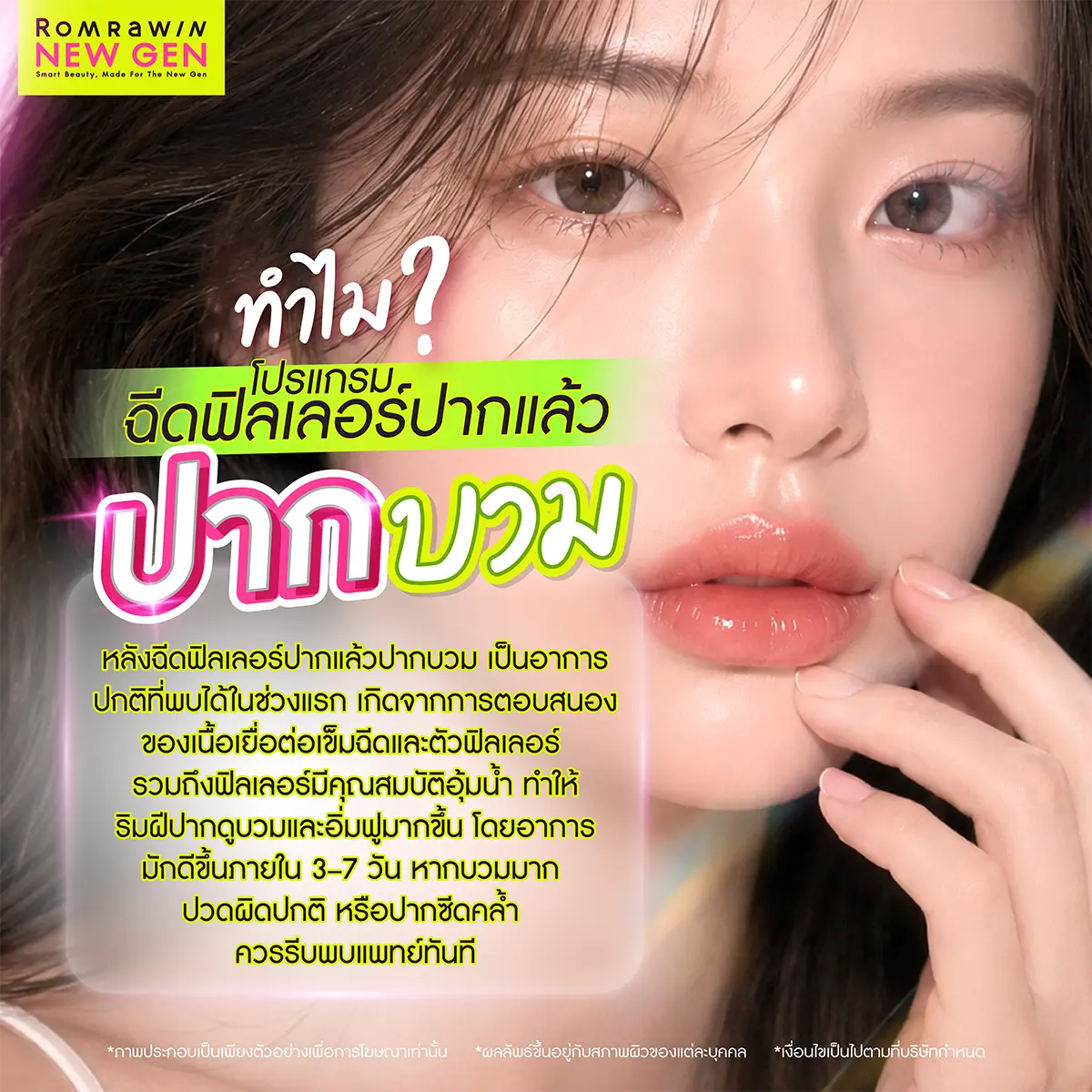 ปากบวม