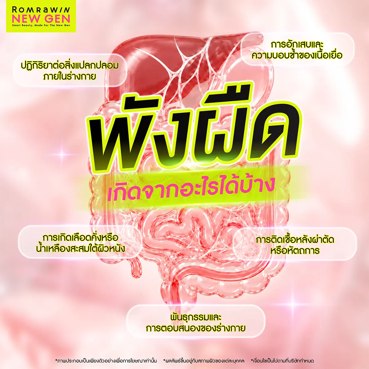 พังผืด
