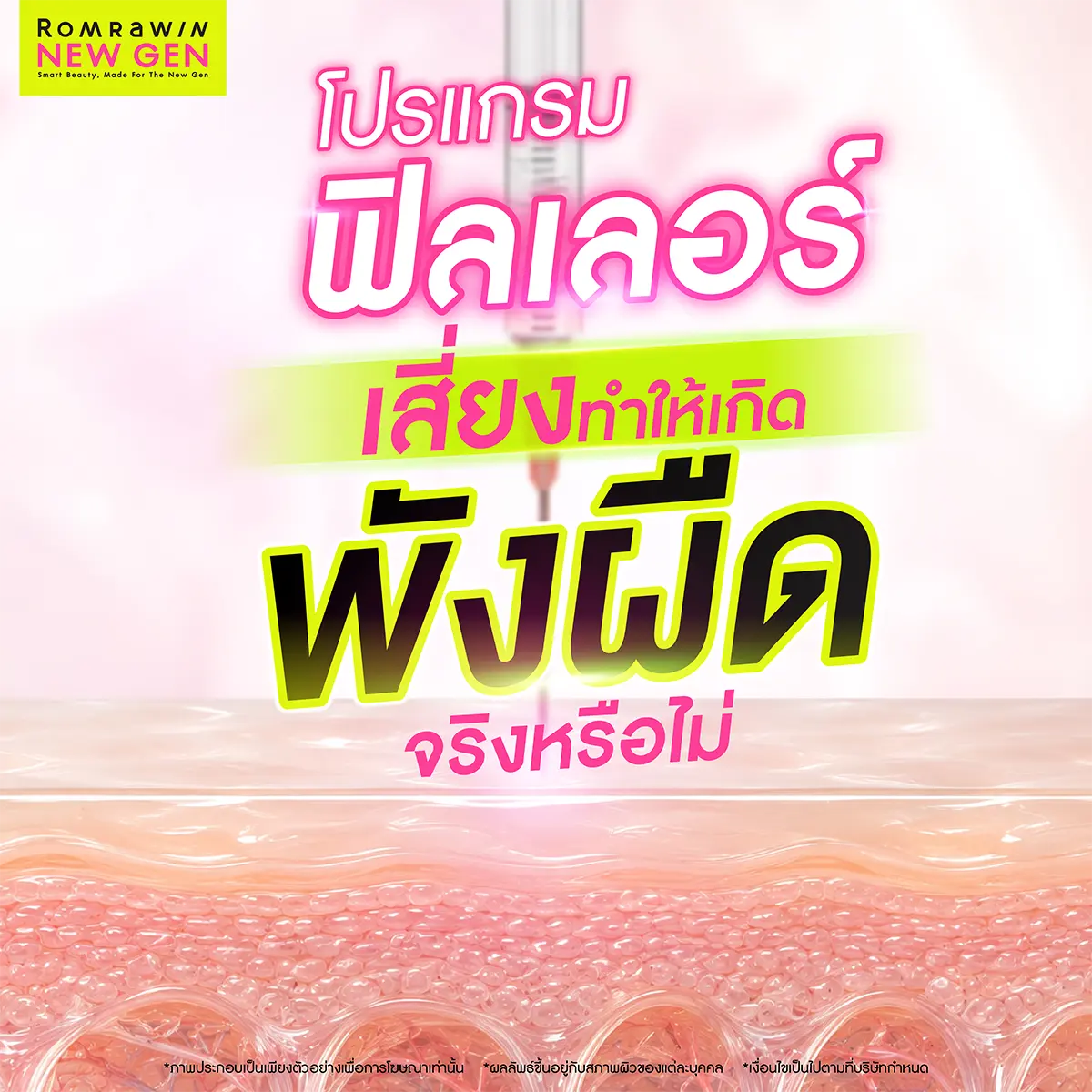 พังผืด