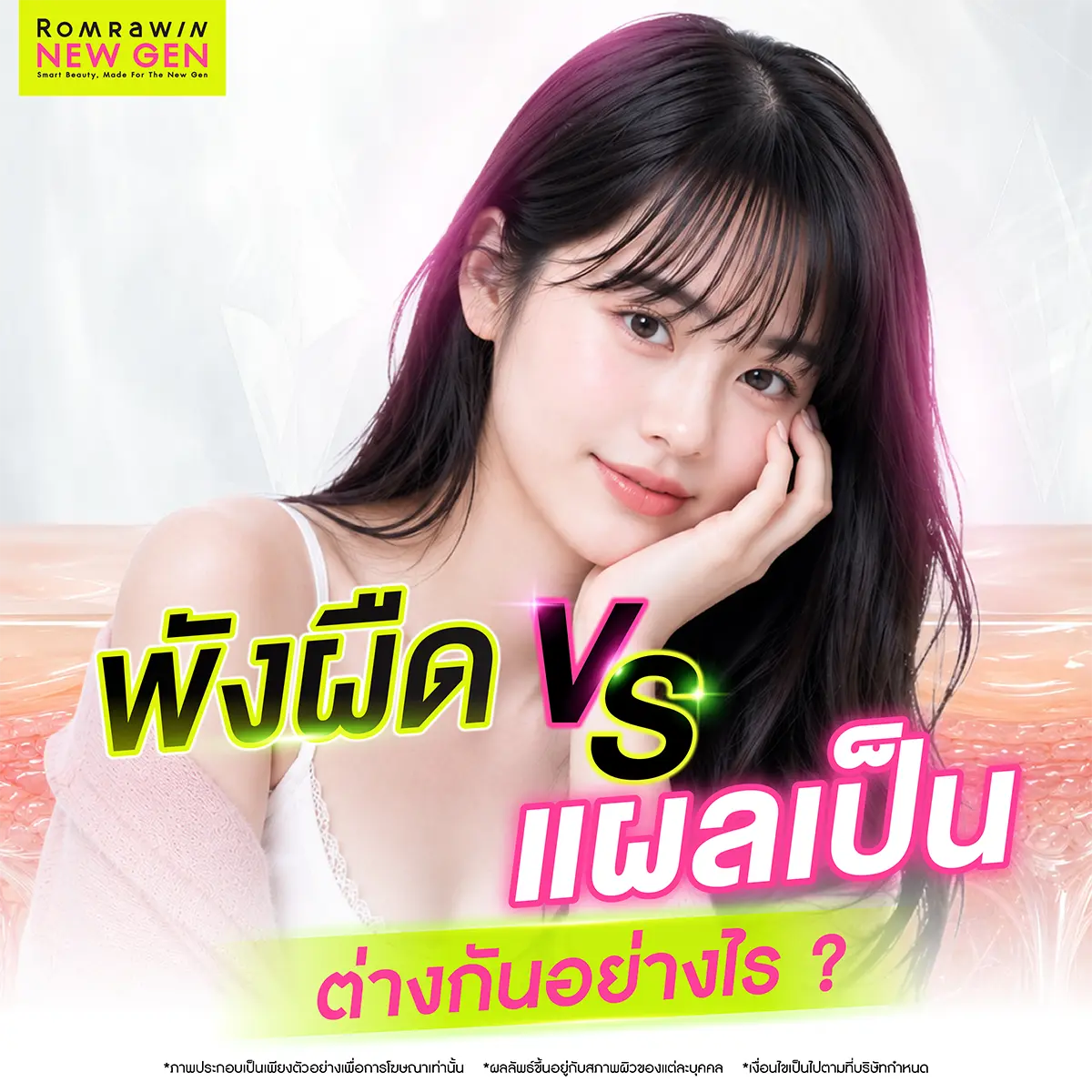 พังผืด