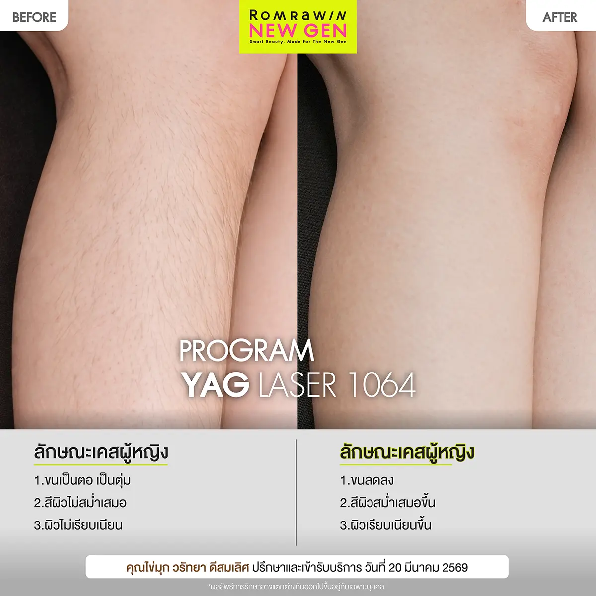 คุณไข่มุก วรัทยา ดีสมเลิศ