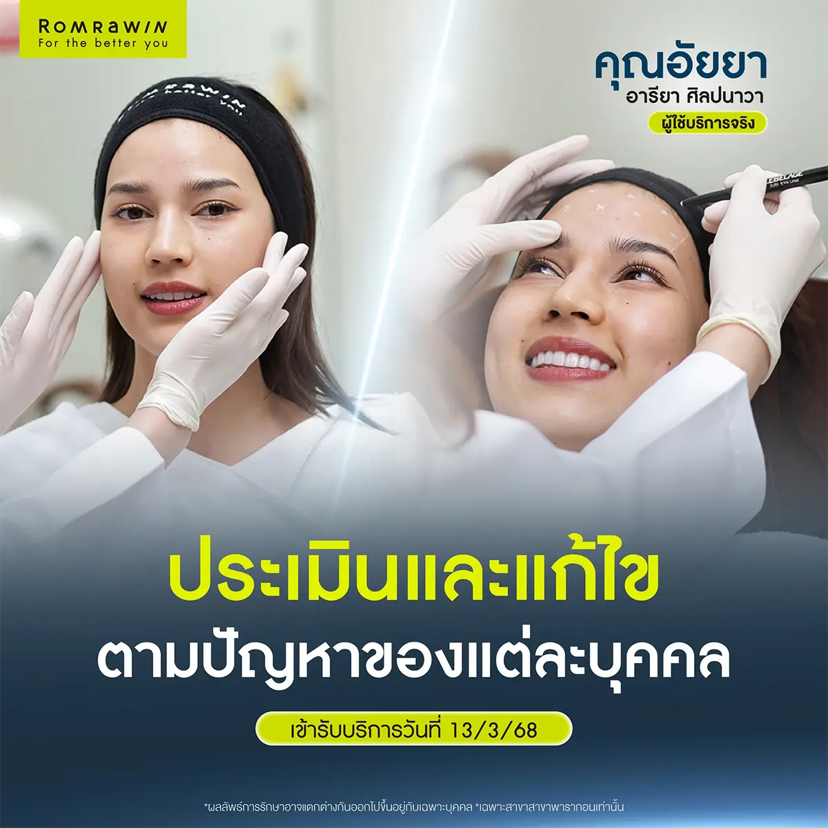 ฟิลเลอร์