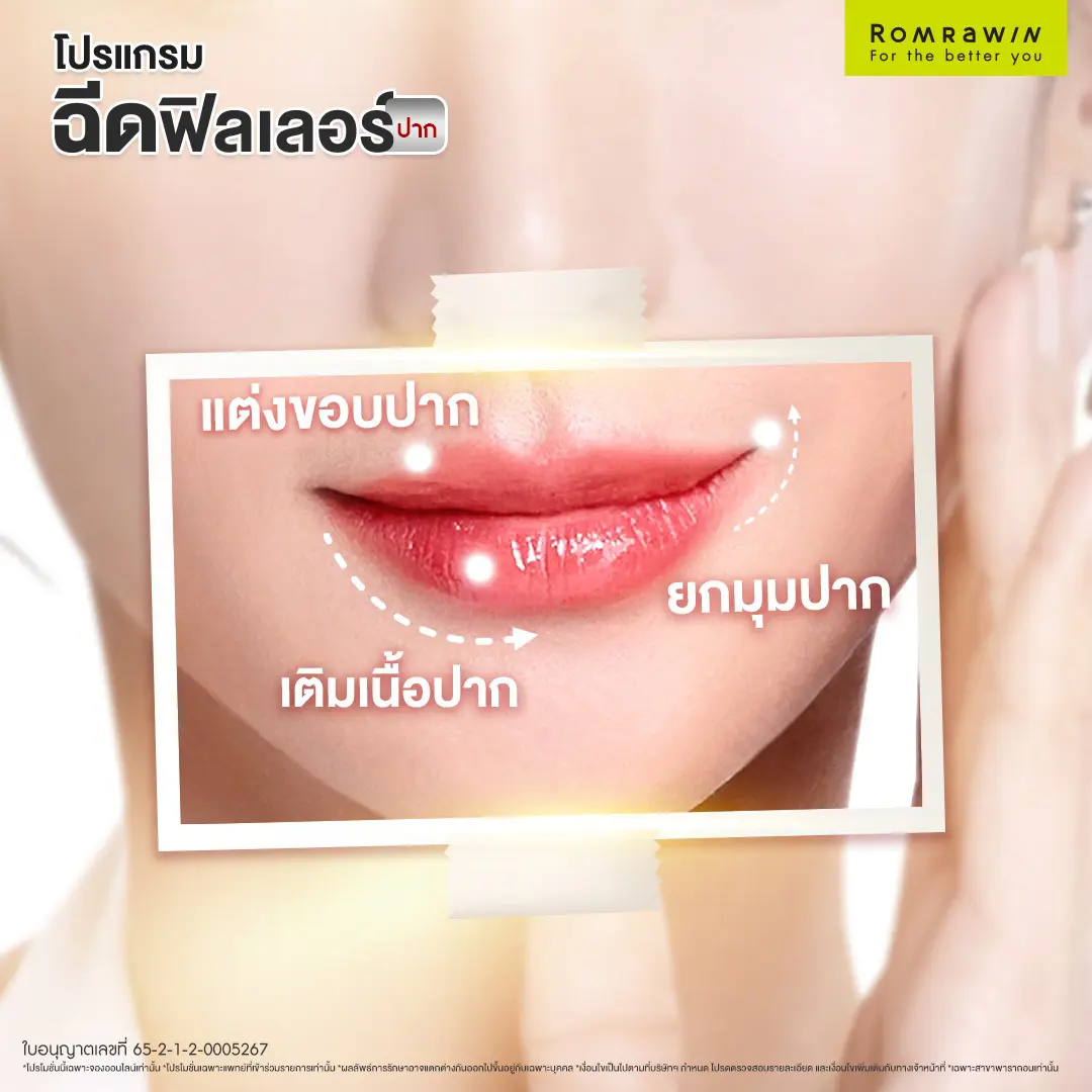 ฟิลเลอร์ปาก