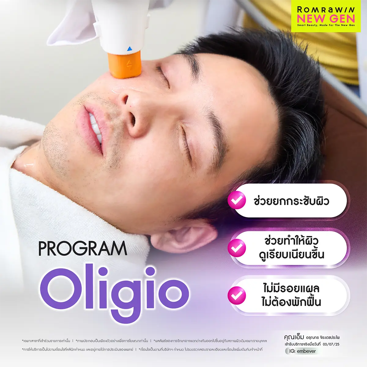 Oligio