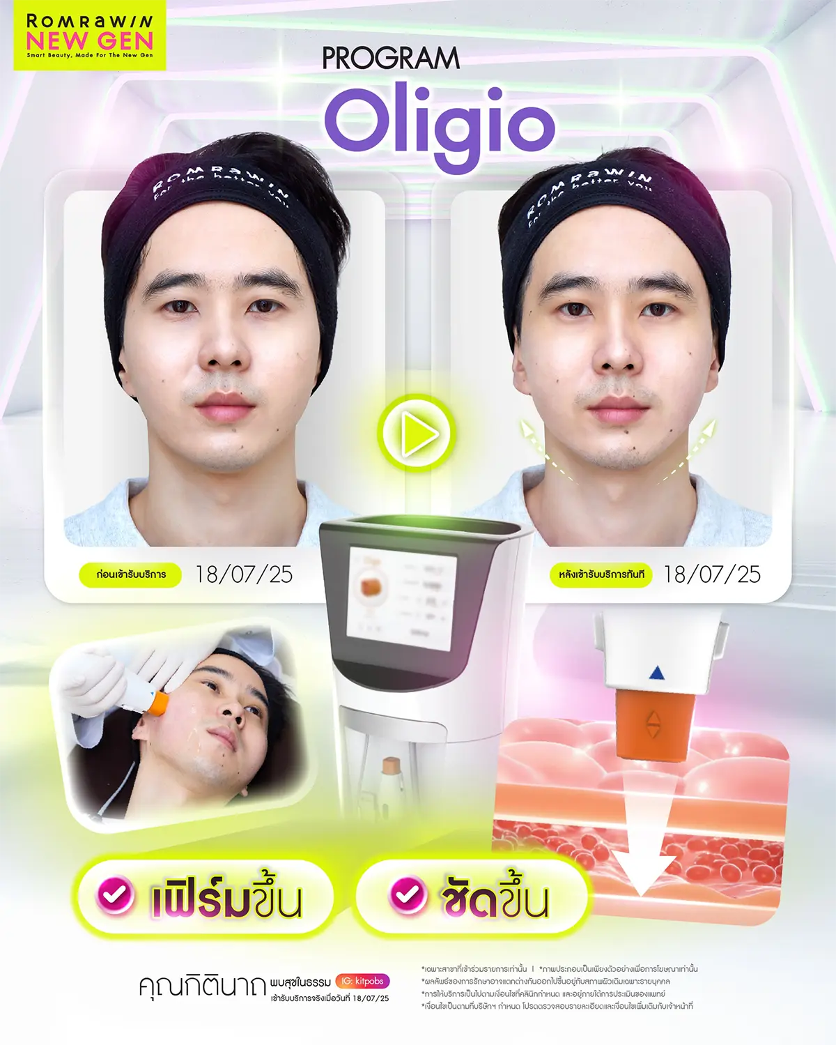 Oligio